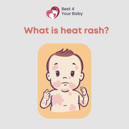 WHAT IS HEAT RASH?